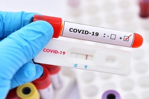 Covid-19, test rapido: si valuta la possibilità di poterlo fare nelle farmacie pugliesi